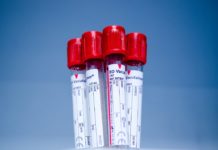 Csütörtökön véradás Dunakeszin