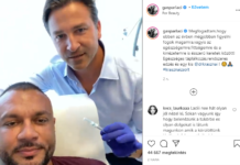 Megszúrták a Dunakeszin élő sztárénekest