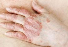 Rüh ütötte fel a fejét egy dunakeszi egyházi intézményben