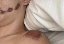 Kétségbeesett üzenet a rollerező gyermekek szüleinek